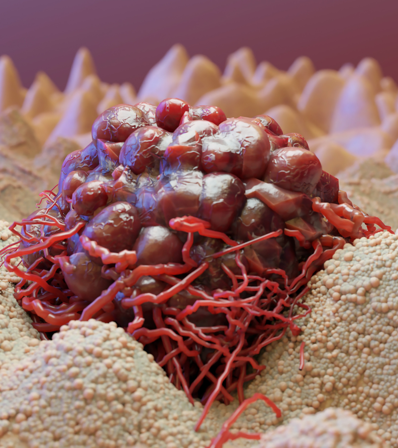 Traitements urologiques