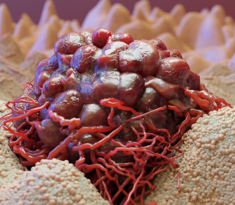 Traitements urologiques